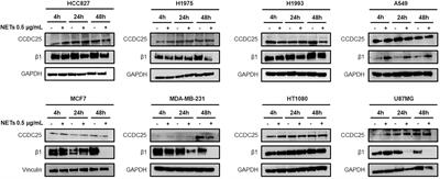 Dynamic roles of neutrophil extracellular traps in cancer cell adhesion and activation of Notch 1-mediated epithelial-to-mesenchymal transition in EGFR-driven lung cancer cells